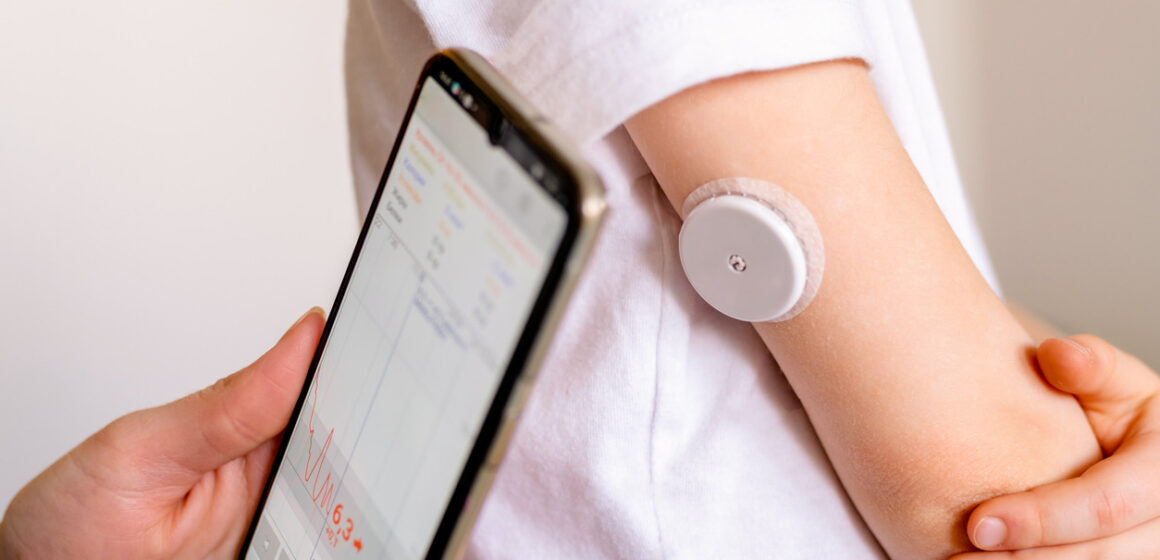 CGM -system of continuous monitoring of glucose on child's arm. В Молдове запускают программу бесплатного обеспечения датчиками для больных диабетом